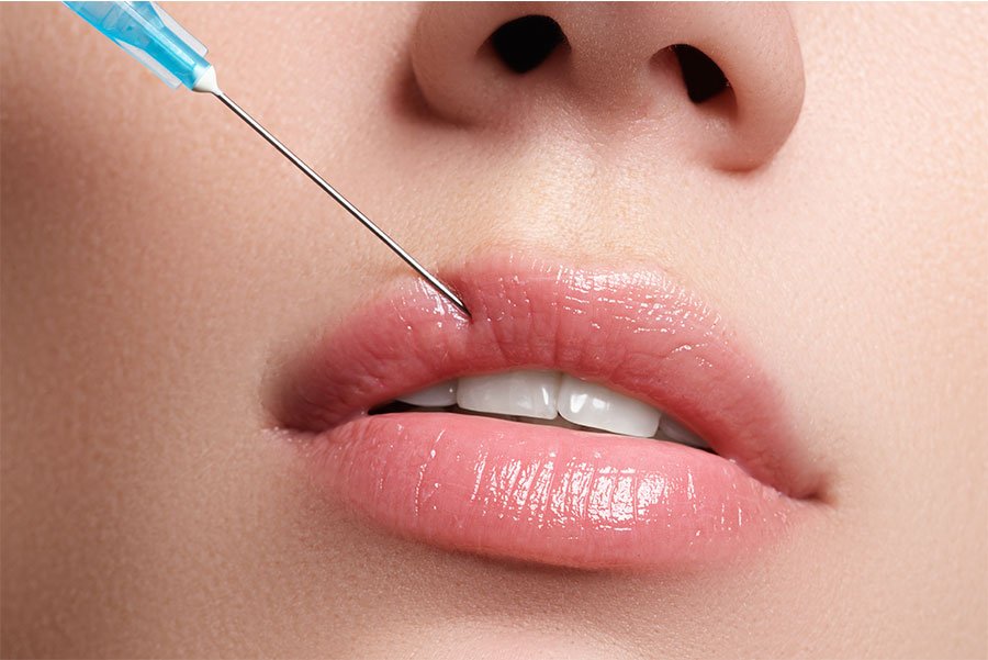 Injections (acide hyaluronique, botox)