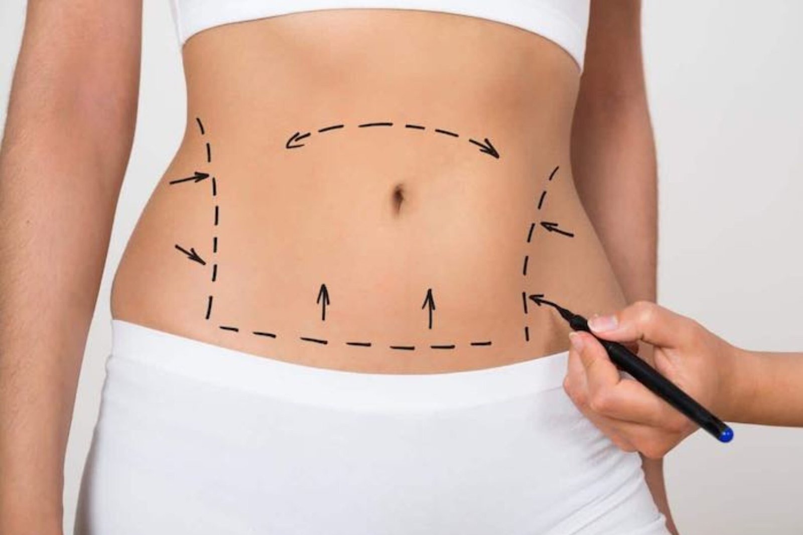 Corps (liposuccion, abdominoplastie, etc.)